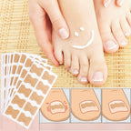 Toe Align Ingrown Nail Corrector Stickers