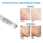 Laser Ultrasonic Skin Tightening Machine